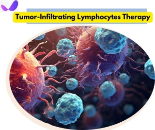 Tumor-Infiltrating Lymphocytes Therapy: Your Cancer Solution?