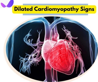 Dilated Cardiomyopathy: Don't Ignore These Warning Signs