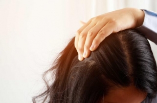 Dandruff ….cause And Treatment