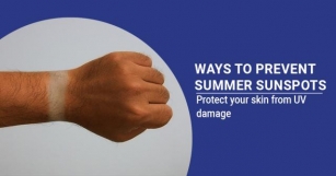 10 Ways To Treat Sunspots On Face In Summer