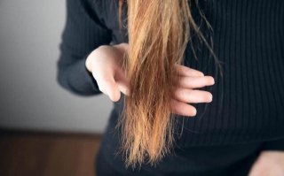 Revive Your Locks: Amazing Home Remedies For Dry Hair!