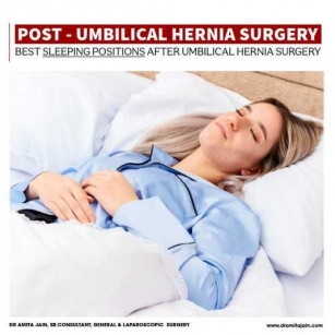Best Sleeping Positions After Umbilical Hernia Surgery