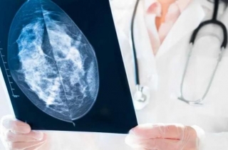 AI Revolution In Breast Cancer Diagnosis At Israeli Hospital