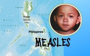 Measles outbreak in the southern Philippines.