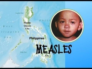 Measles Outbreak In The Southern Philippines.