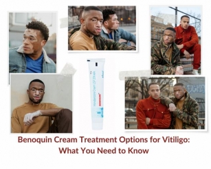Benoquin Cream Treatment Options For Vitiligo: What You Need To Know