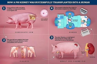 A Gene-Edited Pig Makes History: First-Ever Kidney Transplant To Human Is Successful