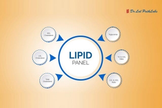 Lipid Profile Test: What It Is, Purpose, Preparation & Results