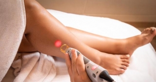 Laser Hair Removal: Everything You Need To Know Before Your First Session