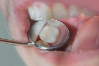 Navigate Dental Plans With Ease At JJ Dental