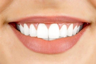 Unlocking The Smile Of Your Dreams With Porcelain Veneers
