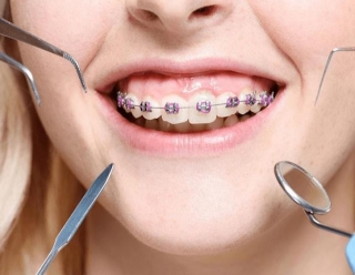 Unveiling The Benefits Of Modern Orthodontic Treatment: A Guide To Straighter Smiles