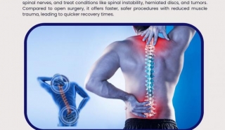 Affordable Back Relief: Your Guide To Minimally Invasive Spine Surgery In India