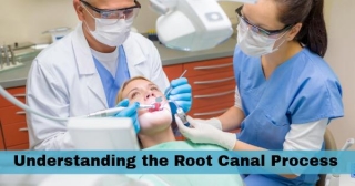Understanding The Root Canal Process