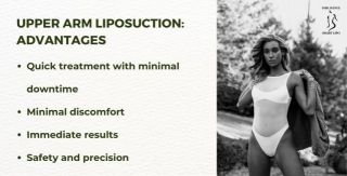 Enhance The Appearance Of Your Arms: Upper Arm Liposuction In NYC Explained