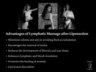 Does Lymphatic Drainage Massage Work After Liposuction?