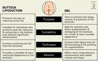 How Does Buttock Liposuction Differ From Brazilian Butt Lift Surgery?