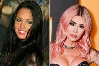 Megan Fox Reveals All The Cosmetic Operations She Has Undergone
