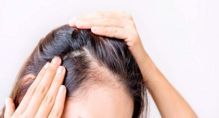 Entendiendo La Alopecia Difusa: Causas, Tratamientos Y Perspectivas