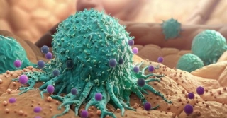 Cancro, Test Di Frontiera Lo Rileva In Pochi Minuti Con Micro Gocce Di Sangue