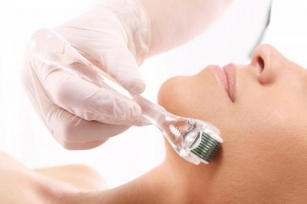 Why You Need The Best Micro Needling Machine For Flawless Complexion