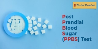 Postprandial Blood Sugar Test (PPBS Test)
