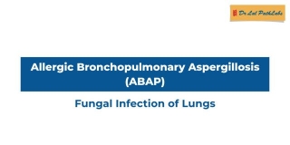 Allergic Bronchopulmonary Aspergillosis (ABPA)