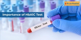 HbA1c Test For Diabetes: Importance And Results
