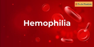 Heemophilia: Causes, Symptoms & Diagnosis