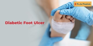 Diabetic Foot Ulcers: Causes & Symptoms