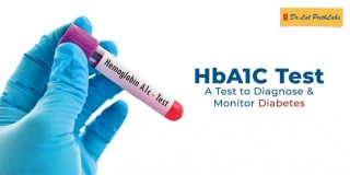 What Is The Best Time For HbA1C Test?