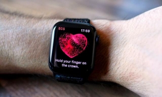 The Apple Watch Is Now Qualified For Clinical AFib Monitoring