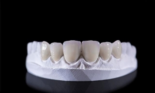 Could Veneers Help Perfect Your Smile?