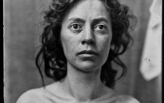 Haunting Portraits Of Surgery Patients Of Dr. Harvey Cushing From The Early 20th Century